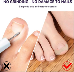 Ayak Tırnağı Düzeltme Bandı 50 Adet