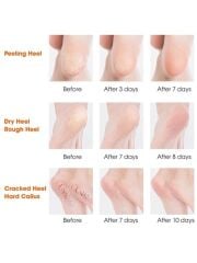 Silikon Topuk Nemlendirici Çorap